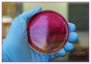 Колония бактерий в чашке Петри